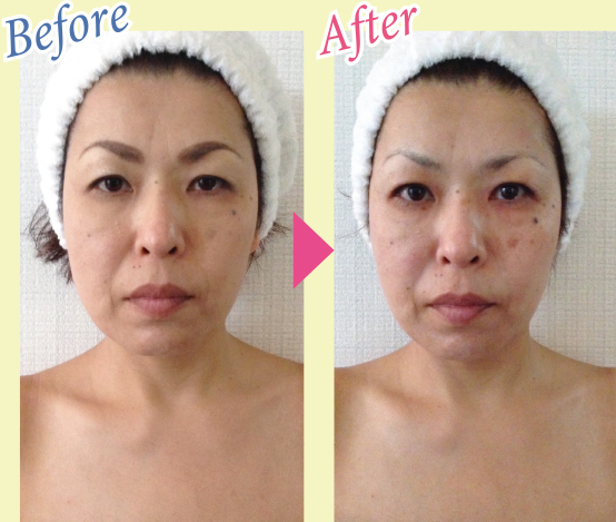 Before & After 写真1