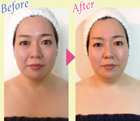 Before & After 写真2