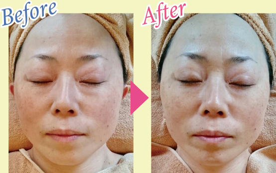 Before & After 写真1