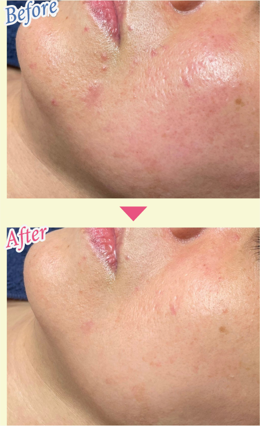 Before & After 写真1