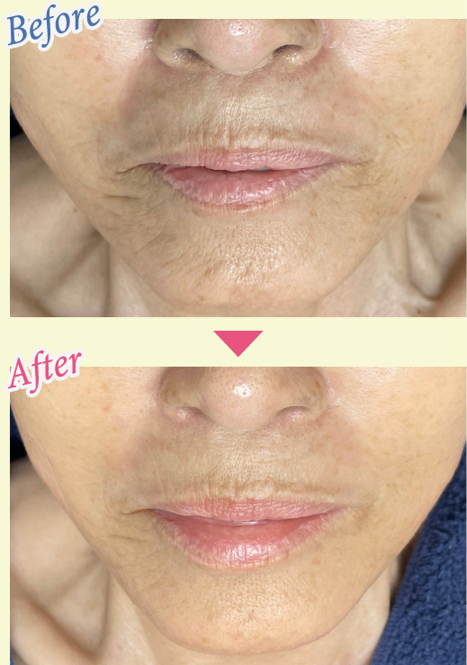 Before & After 写真1