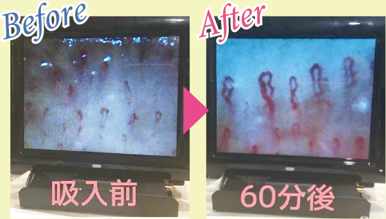 Before & After 写真2